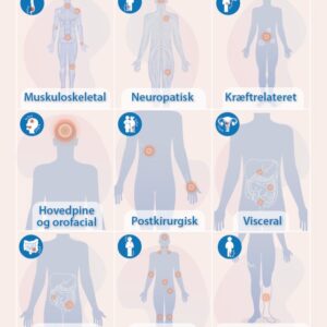 Infographic - almindelige smertetilstande V1