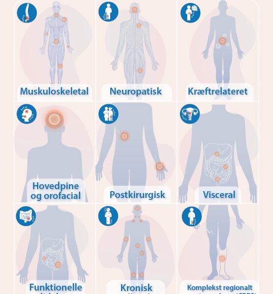 Infographic - almindelige smertetilstande V1