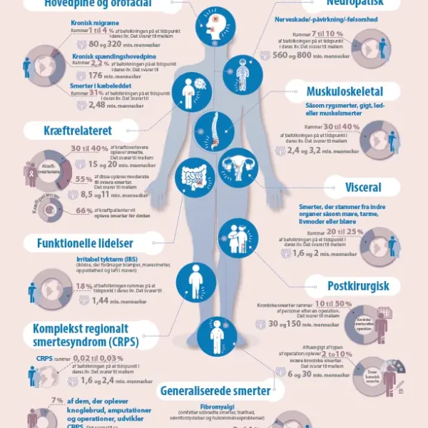 SIP infografik: Forekomst af smerte – infografisk plakat