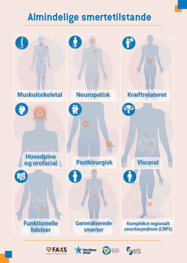 SIP infografik: Almindelige smertetilstande – infografisk plakat